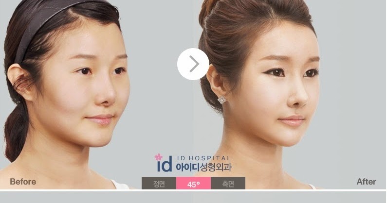 Boob granny old Asian nose rhinoplasty